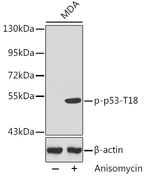 Anti-Phospho-TP53-T18 Antibody (CABP0464)