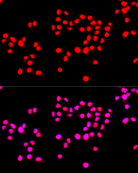 Anti-Ki67 Antibody (CAB2094)