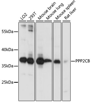 Anti-PPP2CB Antibody (CAB3122)