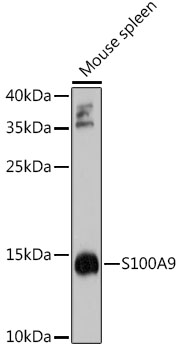 Anti-Protein S100-A9 Polyclonal Antibody (CAB9842)