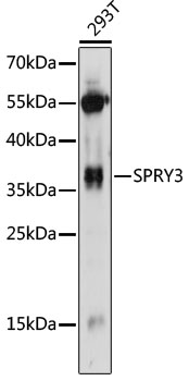 Anti-SPRY3 Antibody (CAB14669)