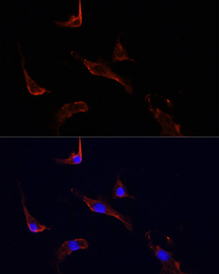 Anti-LGR5 Antibody (CAB10545)