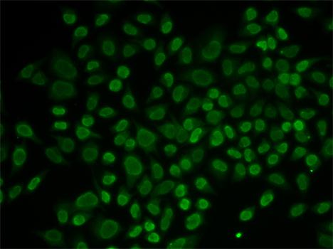 Anti-RAD54L2 Antibody (CAB13585)