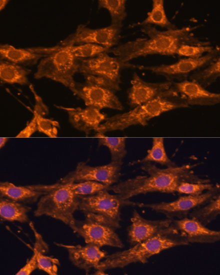 Anti-UBQLNL Antibody (CAB14451)