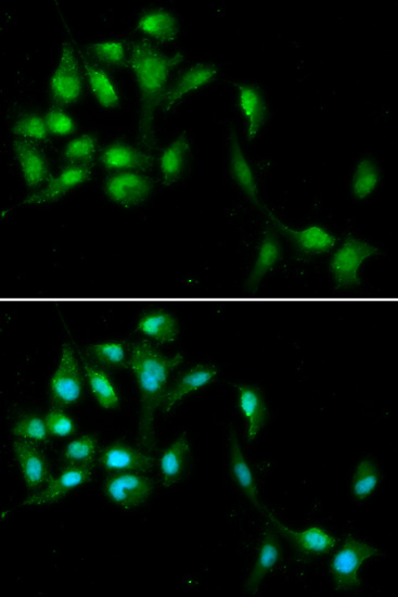 Anti-HEXIM1 Antibody (CAB5775)