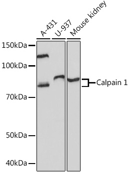 Anti-Calpain 1 Antibody (CAB8710)