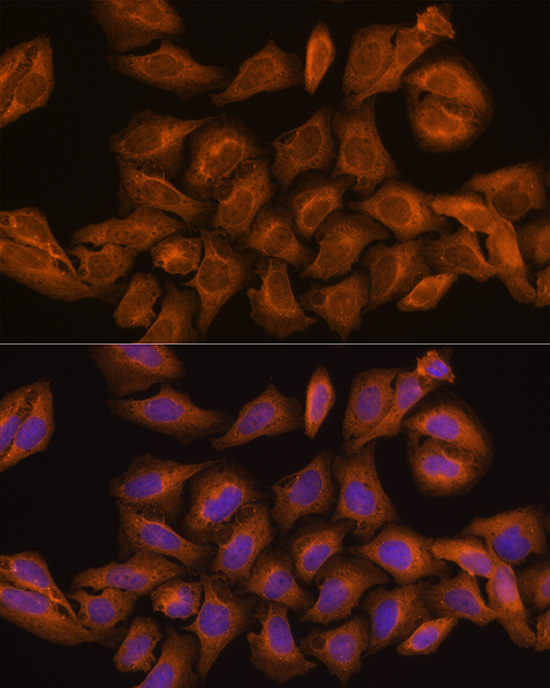 Anti-RNH1 Antibody (CAB4079)