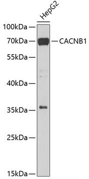 Anti-CACNB1 Antibody (CAB7649)