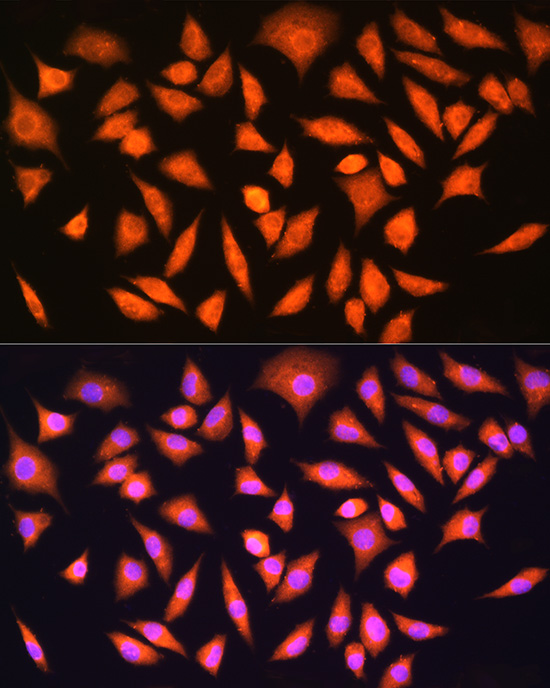 Anti-HINT1 Antibody [KO Validated] (CAB10221)