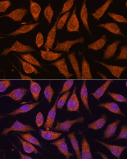 Anti-SMYD3 Antibody (CAB14516)