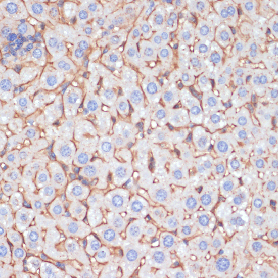 Anti-APOA1 Antibody (CAB14211)