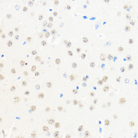 Anti-BRCA1 Antibody (CAB11549)