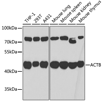 Anti-Beta Actin Antibody (CABC006)