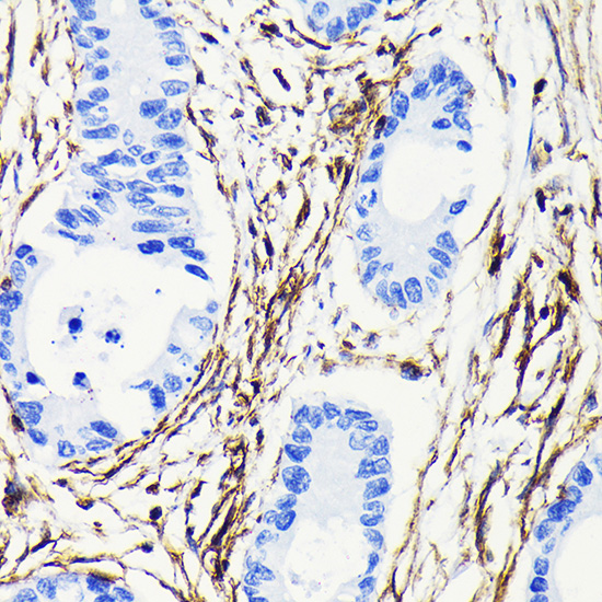 Anti-Vimentin Antibody [KO Validated] (CAB19607)