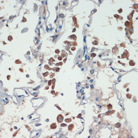 Anti-APC Antibody (CAB2818)