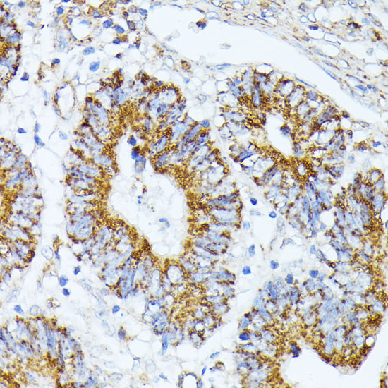 Anti-TRAP1 Antibody (CAB2748)