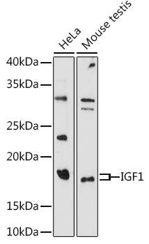 Anti-IGF1 Antibody (CAB0303)