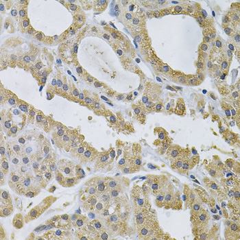 Anti-NCF4 Antibody (CAB2096)