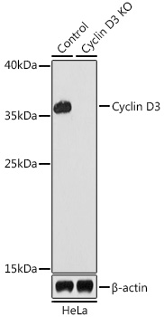 Anti-Cyclin D3 Antibody [KO Validated] (CAB0746)