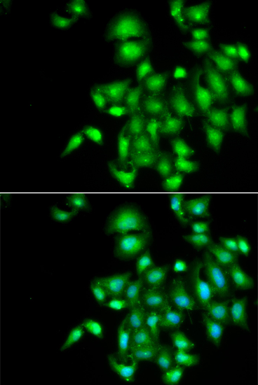 Anti-IL-20 Antibody (CAB6629)