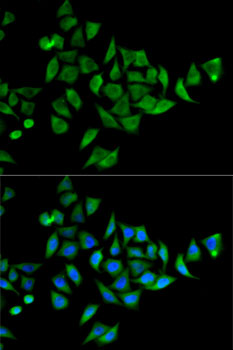 Anti-DOK1 Antibody (CAB5687)