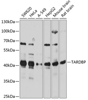 Anti-TARDBP Antibody (CAB13404)