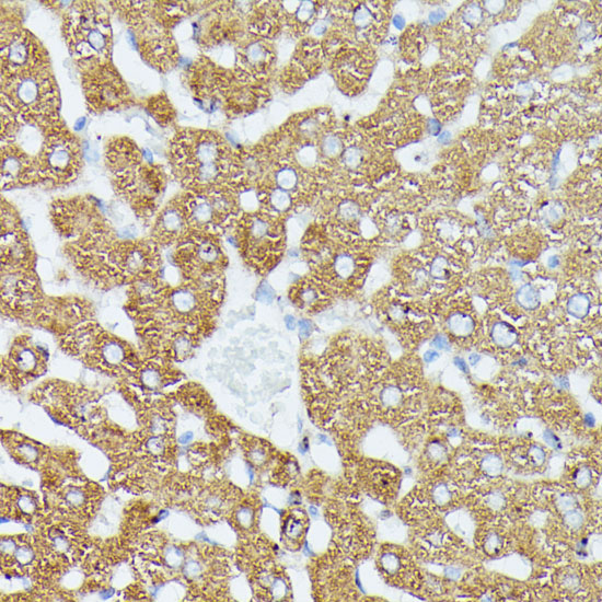 Anti-MAP3K1 Antibody (CAB16057)