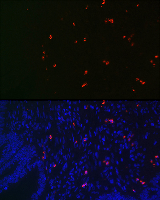 Anti-MPO Antibody (CAB1374)