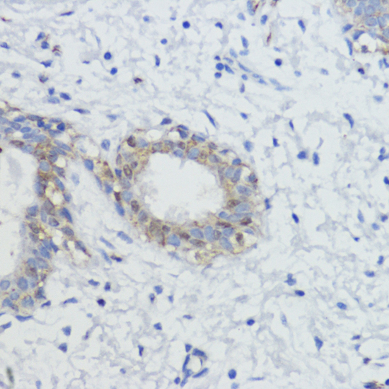 Anti-AKT1 Antibody (CAB11016)