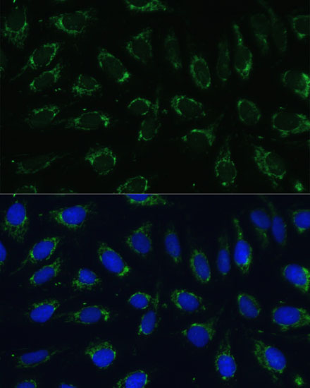 Anti-NDUFA4 Antibody (CAB15693)