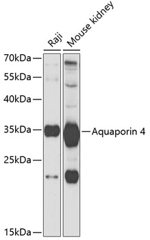 Anti-Aquaporin 4 Antibody (CAB5665)