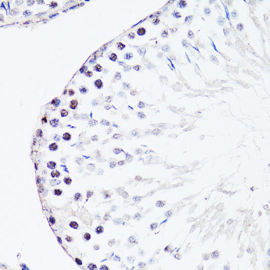 Anti-FGF12 Antibody (CAB2667)