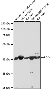 Anti-PDK4 Antibody (CAB13337)