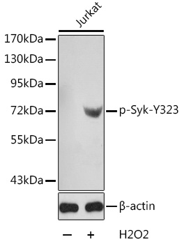 Anti-Phospho-SYK-Y323 Antibody (CABP0291)