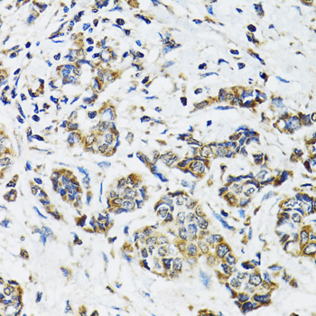 Anti-SSBP1 Antibody (CAB6987)