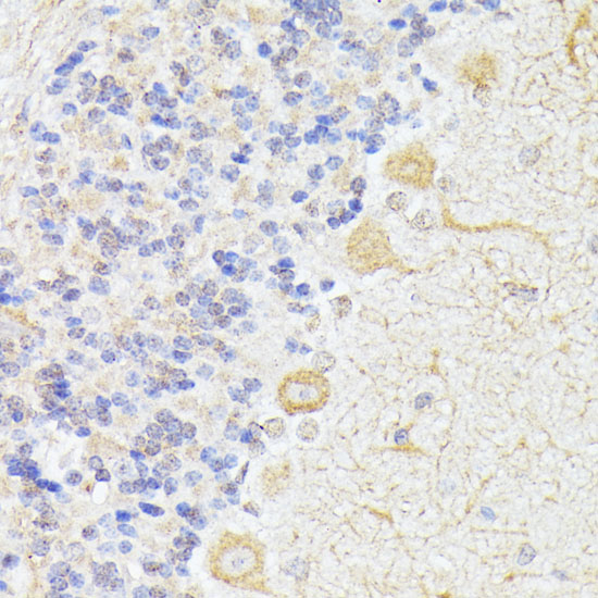 Anti-ELP3 Polyclonal Antibody (CAB9877)