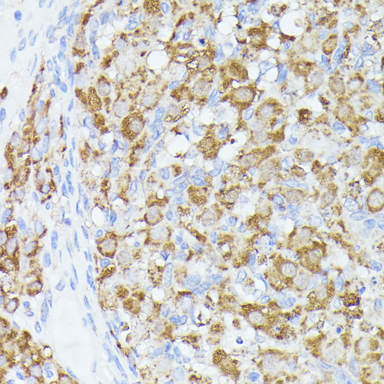 Anti-ACAT2 Antibody (CAB7866)