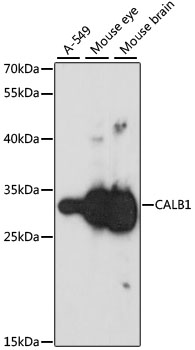 Anti-CALB1 Antibody (CAB0802)