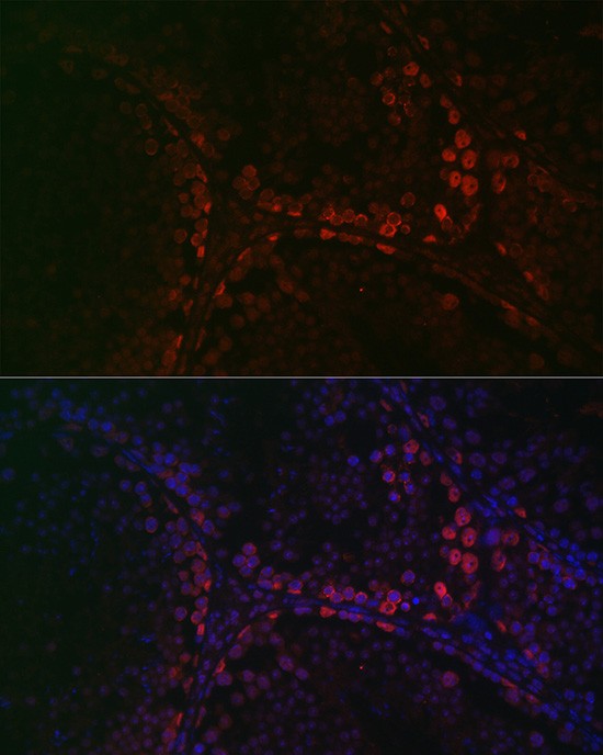 Anti-DAZL Antibody (CAB13970)