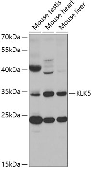 Anti-KLK5 Antibody (CAB2991)