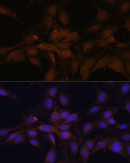 Anti-YAP1 Antibody (CAB1001)