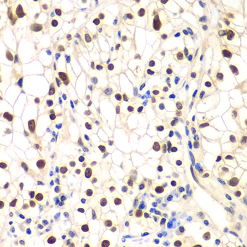 Anti-NFKBIB Antibody (CAB5777)