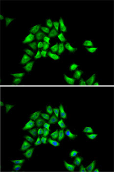 Anti-DCTN1 Antibody (CAB1783)