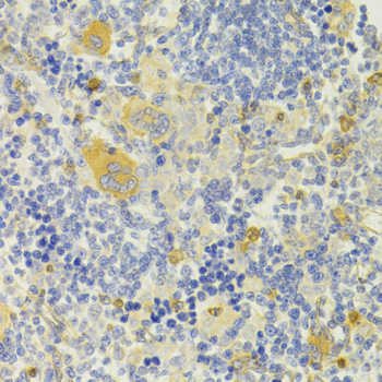 Anti-DPP3 Antibody (CAB7054)