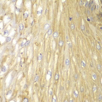 Anti-PPP2R2A Antibody (CAB2185)