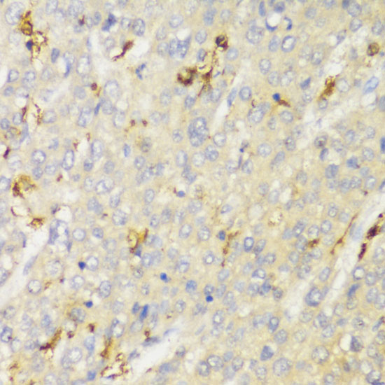 Anti-HLA-DPB1 Antibody (CAB13997)