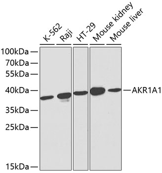 Anti-AKR1A1 Antibody (CAB1068)