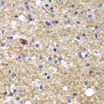 Anti-CDK6 Antibody (CAB0705)