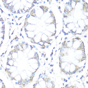 Anti-SDHB Antibody (CAB10821)