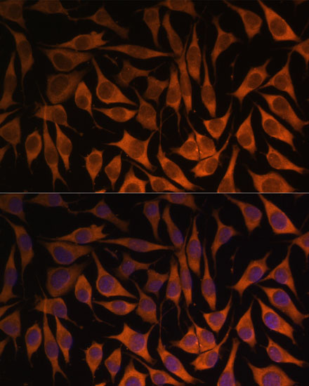 Anti-MRPS35 Antibody (CAB15878)